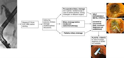 Trans-papillary bilio-pancreatic stenting: When how and which stent
